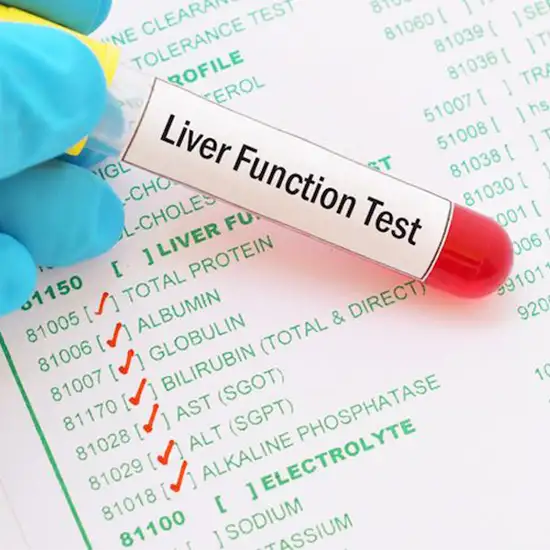 GDIC Liver Function Test Package-1 class=